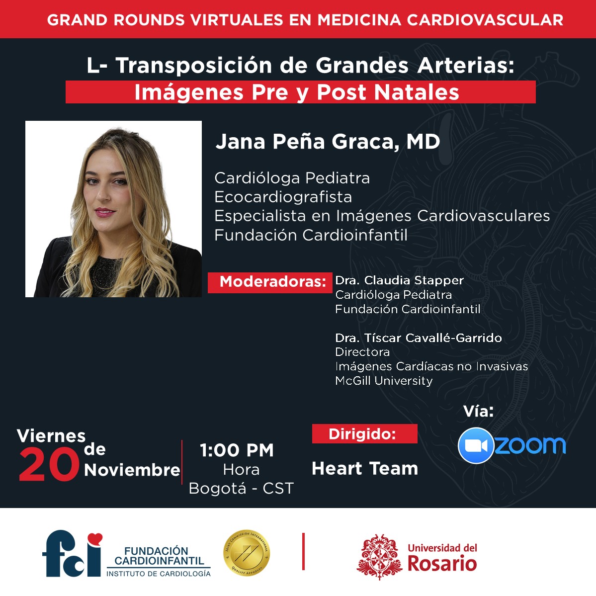 Webinar: L- Transposición de Grandes Arterias: Imágenes Pre y Post Natales