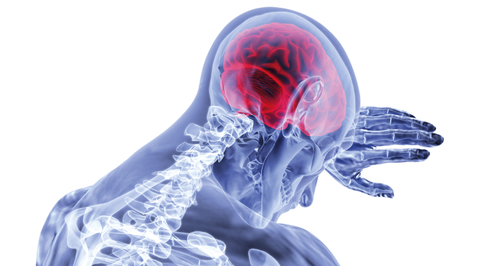 ¿Conoces los signos y síntomas de un ataque cerebrovascular o ACV?