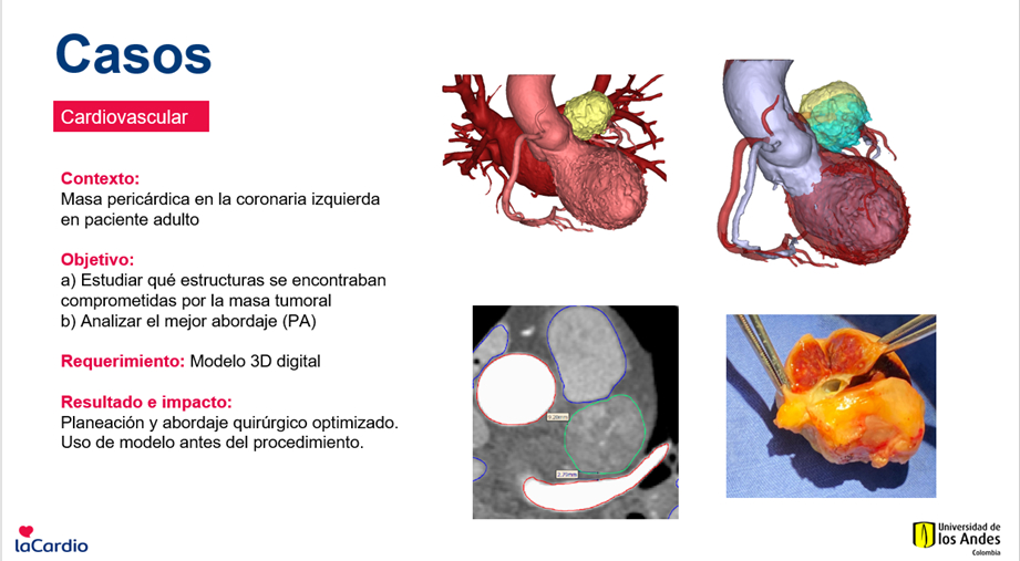 Caso 1