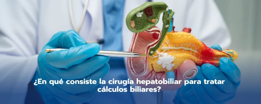 ¿En qué consiste la cirugía hepatobiliar para tratar cálculos biliares?