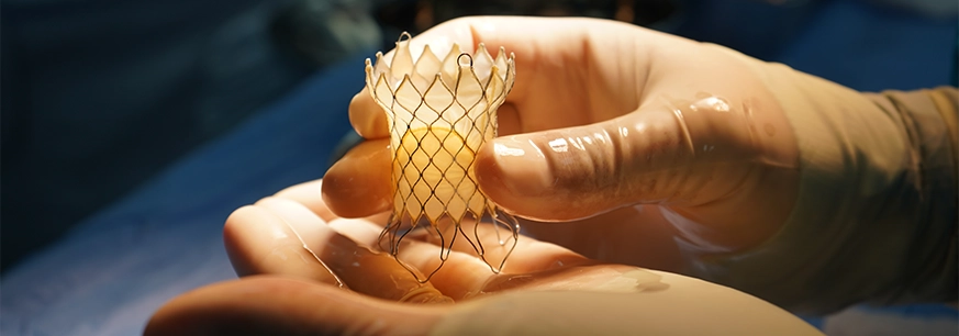 Procedimientos terapéuticos - LaCardio