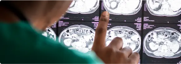 Neurocirugía Cerebral - LaCardio