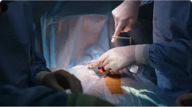 Trasplante de Hígado - LaCardio