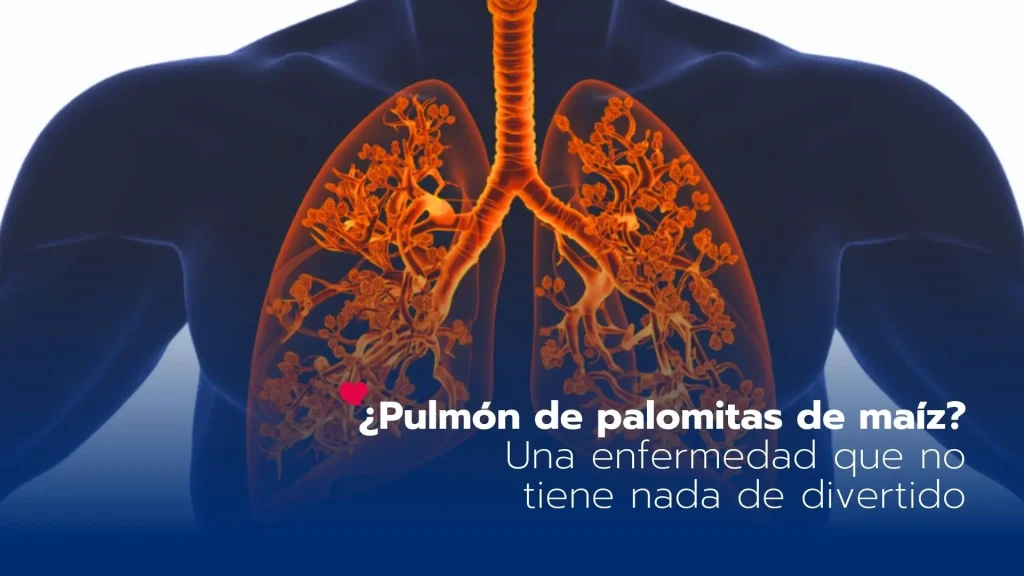 ¿Pulmón de palomitas de maíz? Una enfermedad que no tiene nada de divertido