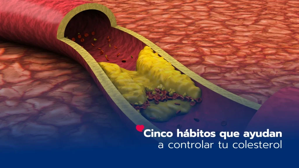 Cinco hábitos que pueden marcar la diferencia en tu colesterol