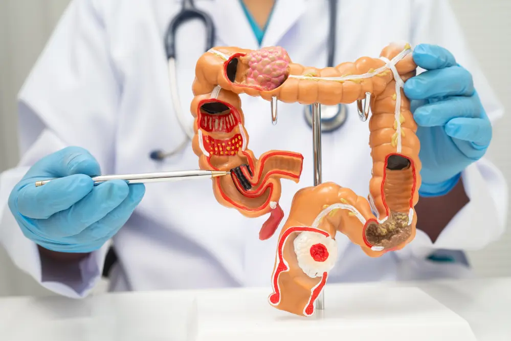 Cirugía colorrectal y Patología anorectal - LaCardio