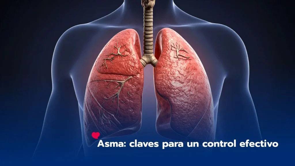 Asma: claves para un control efectivo y una mejor calidad de vida