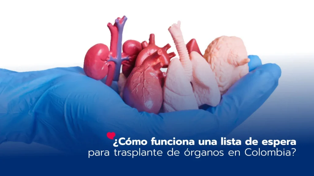 ¿Cómo funciona una lista de espera para trasplante de órganos en Colombia?