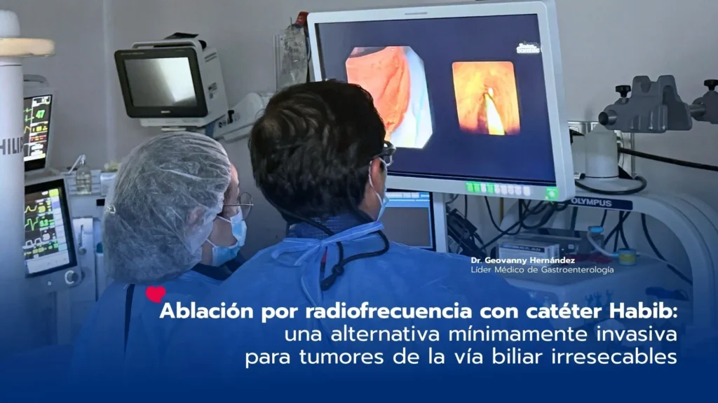 Ablación por radiofrecuencia con catéter Habib: una alternativa mínimamente invasiva para tumores de la vía biliar irresecables