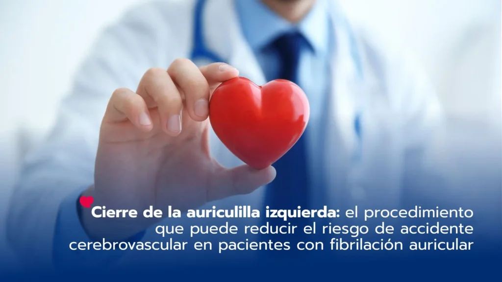 Cierre de la auriculilla izquierda: el procedimiento que puede reducir el riesgo de accidente cerebrovascular en pacientes con fibrilación auricular