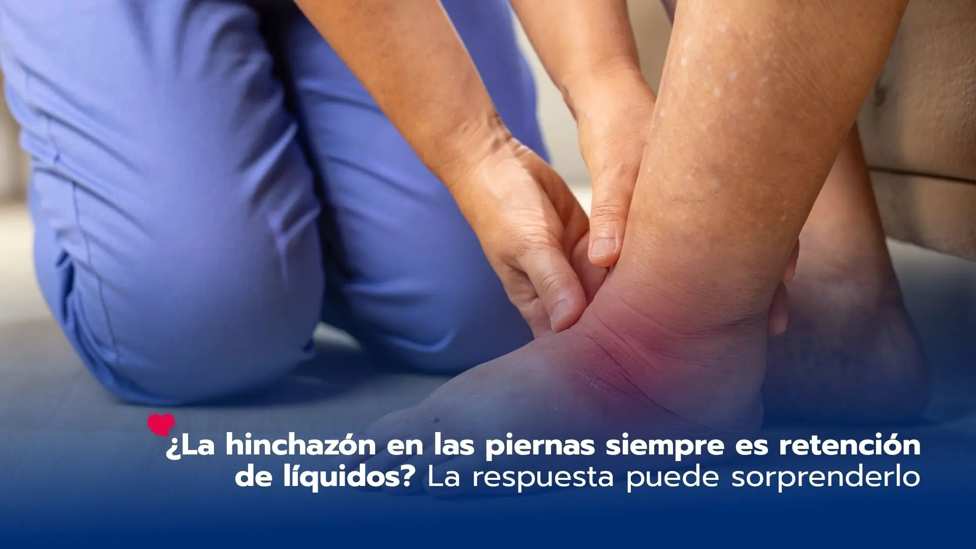 ¿La hinchazón en las piernas siempre es retención de líquidos? La respuesta puede sorprenderlo