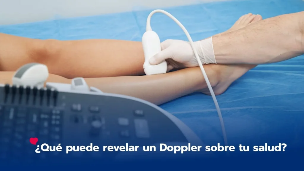 ¿Qué puede revelar un Doppler sobre tu salud?