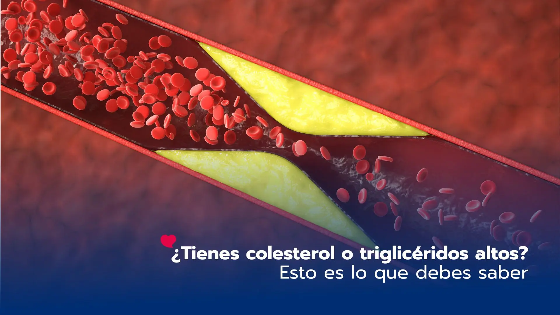 ¿Tienes colesterol o triglicéridos altos? Esto es lo que debes saber