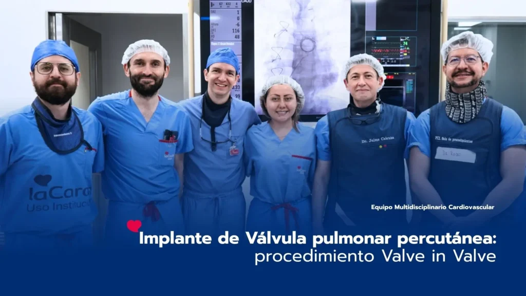 Implante de Válvula pulmonar percutánea: procedimiento Valve in Valve