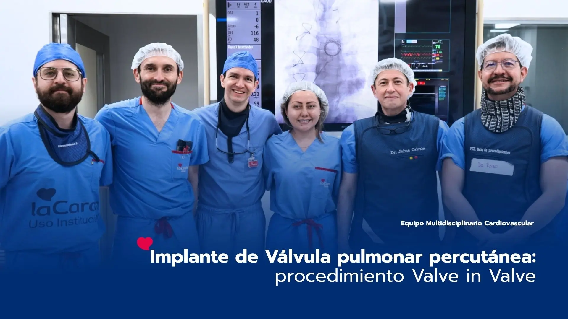 Implante de Válvula pulmonar percutánea: procedimiento Valve in Valve