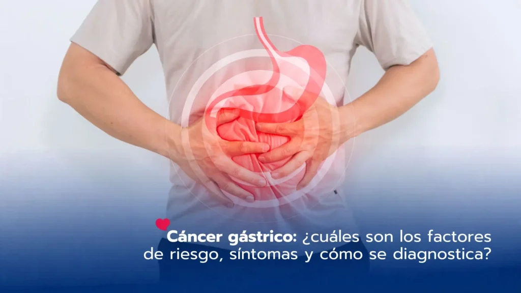 Cáncer gástrico: ¿cuáles son los factores de riesgo, síntomas y cómo se diagnostica?