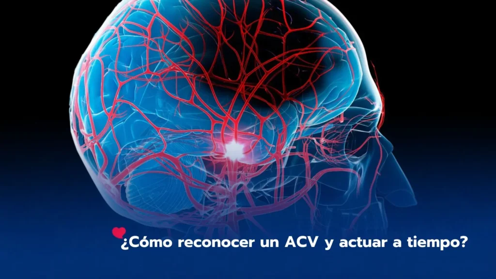 ¿Cómo reconocer un ACV y actuar a tiempo?