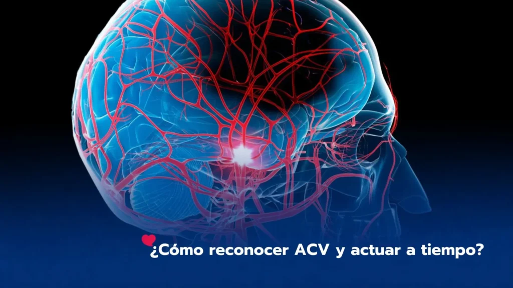 ¿Cómo reconocer ACV y actuar a tiempo?