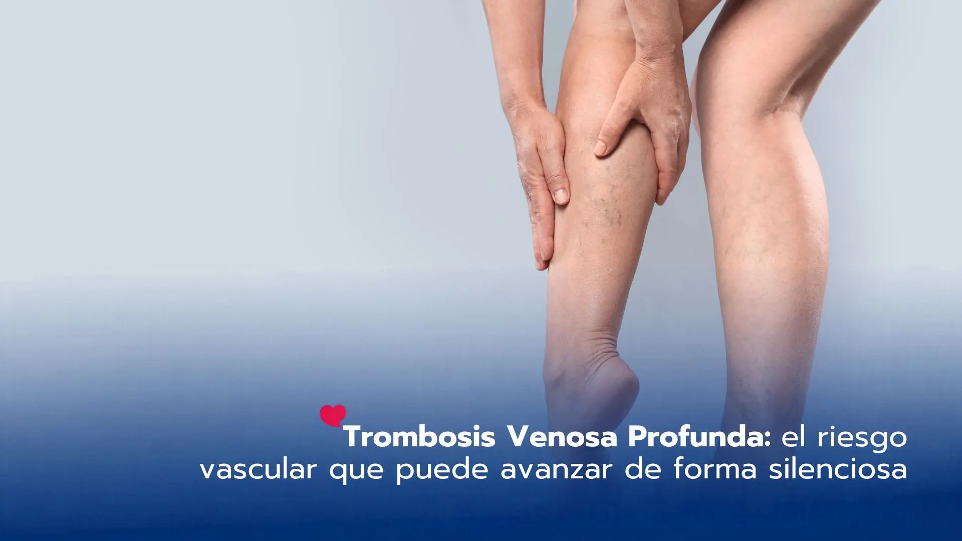 Trombosis Venosa Profunda: el riesgo vascular que puede avanzar de forma silenciosa